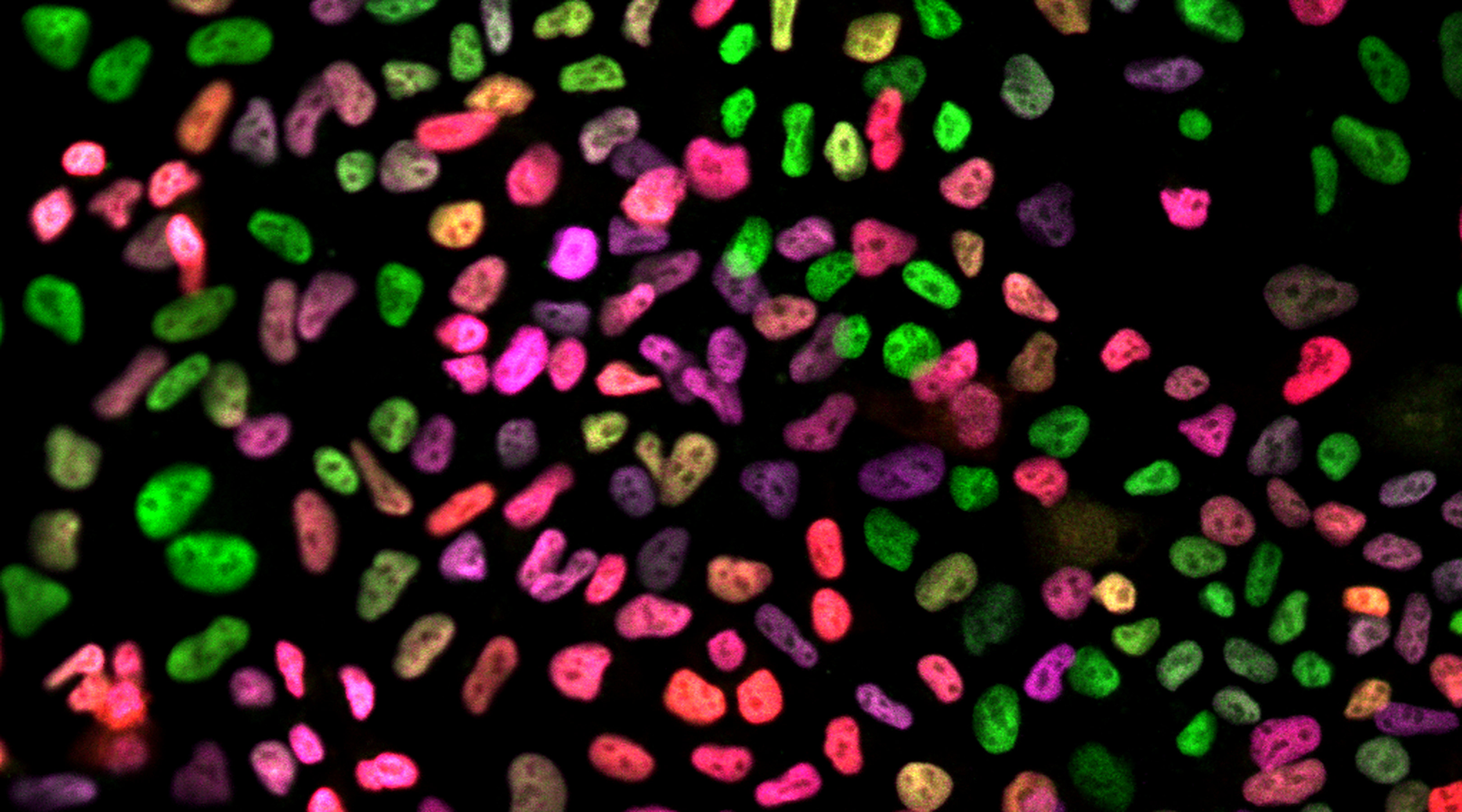 Immunofluorescence of an early endoderm differentiation: nuclei labelled for OCT4, EOMES and Brachyury